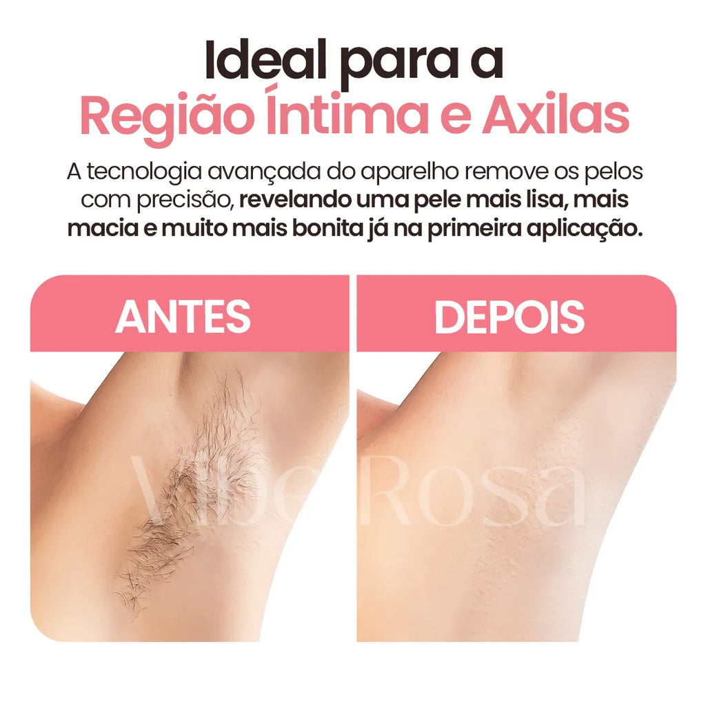 Depilador DermaPure® Elétrico 4 em 1