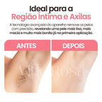 Depilador DermaPure® Elétrico 4 em 1